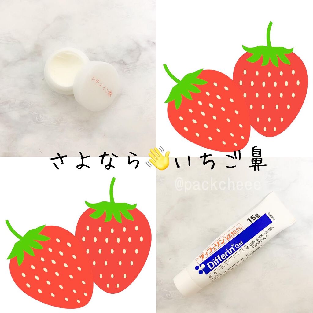 エピデュオゲル 医薬品 を使った口コミ いちご鼻経過 毛穴悩みはほんと尽き By Packcheee 混合肌 30代前半 Lips