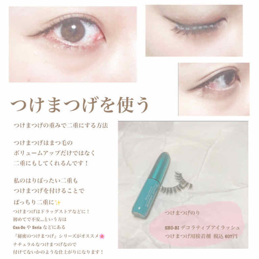 Ripiれるまつげ アネックスジャパンを使った口コミ ぱっちり二重術 つ By えむむ アトピー肌 代前半 Lips