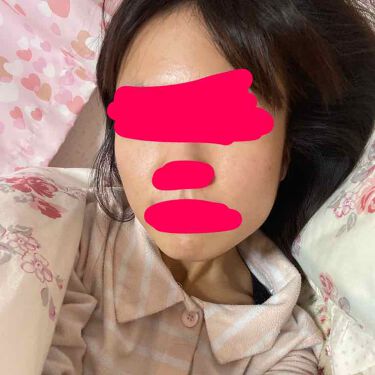 クリアクネア Dhcを使った口コミ 私のニキビ肌からのニキビ跡の残った肌を綺麗 By Moka 普通肌 代前半 Lips