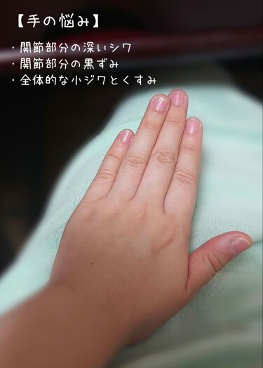 リフレッシュプラス ホワイトニング ボディミルク ニベアを使った口コミ 1つ前の投稿にてネイルケアについて紹介しま By ヒバリヤ 混合肌 代後半 Lips