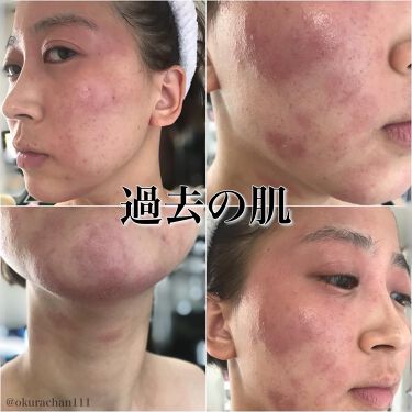 あなたはどっち派 Rhythm Vs Bela Vela シートマスク パックを徹底比較 炭酸ガスパック比較 By おくらちゃん 美容 乾燥肌 30代前半 Lips あなたはどっち派 Rhythm Vs Bela Vela シートマスク パックを徹底比較 炭酸ガスパック比較 By おくらちゃん 美容 乾燥肌 30代前半 Lips