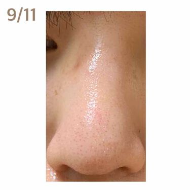 ジョンソンベビーオイル微香性 ジョンソンベビーの口コミ 4日目 今までは鼻のザラザラが取れる感じ By くじら 乾燥肌 10代後半 Lips