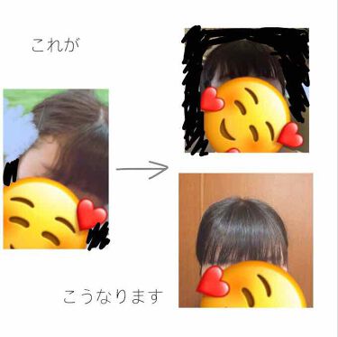 あんず油 柳屋あんず油を使った口コミ こんにちは 白ごまです 私の前髪はくせ毛 By 白ごま 混合肌 10代後半 Lips