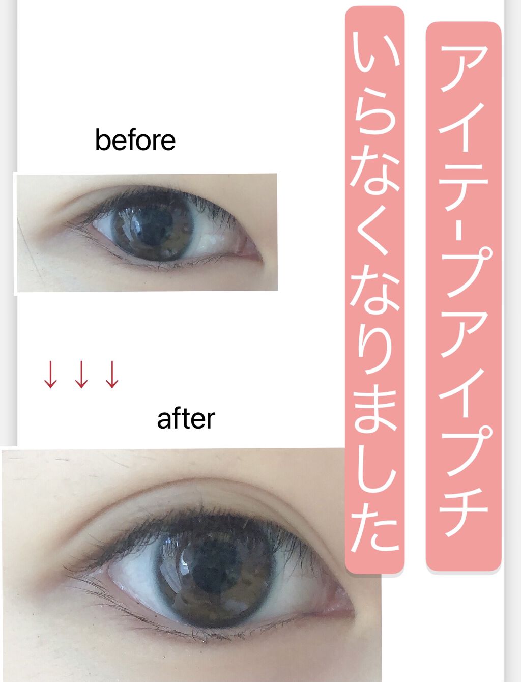 のび る アイテープ 絆創膏タイプ Daisoの口コミ 超優秀 100均で買えるおすすめ二重まぶた用アイテム アイプチ アイテープ By あすか 乾燥肌 10代後半 Lips