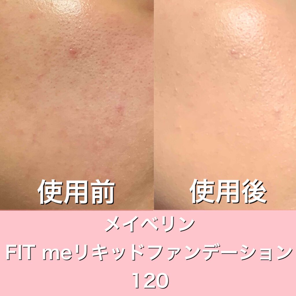 メイベリン フィットミー リキッドファンデーション R Maybelline New Yorkの色味は 色選びの参考になる口コミ 乾燥肌におすすめのリキッドファンデーション カバー力とツヤ感半端な By ぴくみょん 敏感肌 代前半 Lips