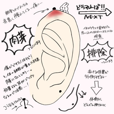 オキシドール 医薬品 日本薬局方を使った口コミ これを見ればピアスマスター By つるこ Lips