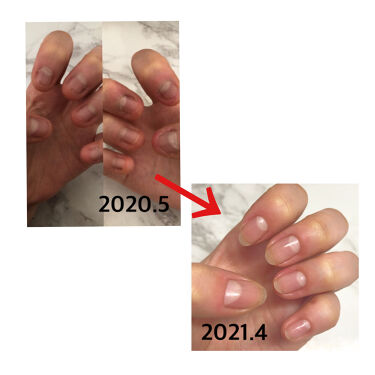 年代 肌質別 ディープセラム Dr Nailの口コミ 118件 Lips