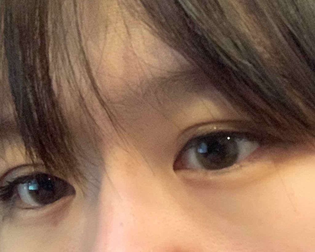 ルドゥーブル ルドゥーブルの口コミ もともと奥二重なので綺麗な二重は諦めていま By Pink Glow 2k38 乾燥肌 代前半 Lips