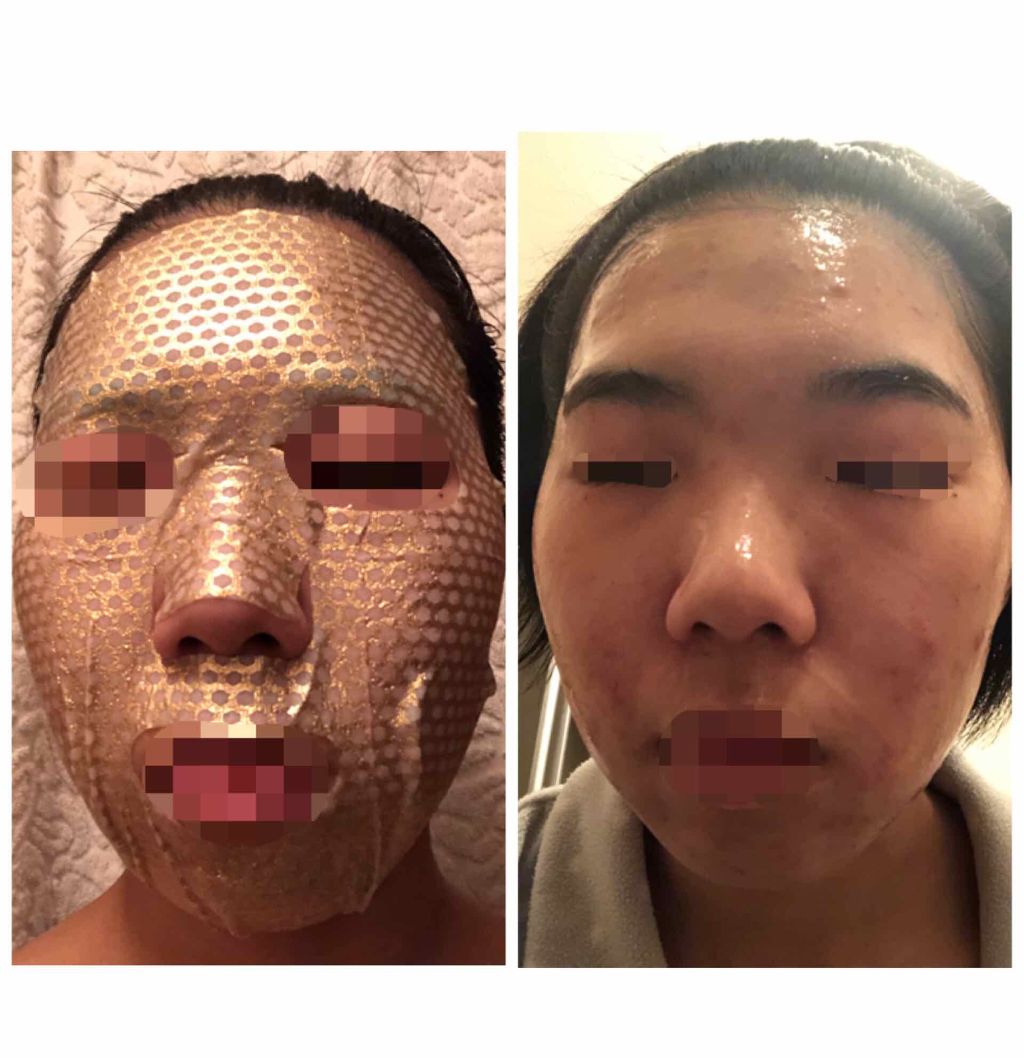 Gold Propolis Injection Mask Banobagiの口コミ 乾燥肌におすすめのシートマスク パック 2枚目顔注意 1 By はるか 脂性肌 代前半 Lips