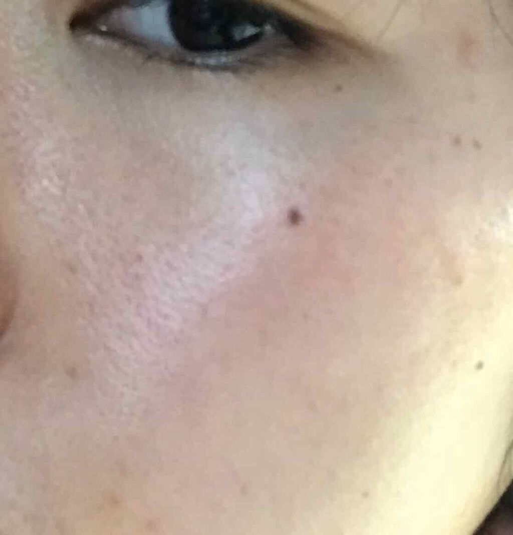 おうちdeエステ 肌をやわららかくする マッサージ洗顔ジェル ビオレを使った口コミ アドバイスほしいです 鼻横 の毛穴と赤みに By ひぎぃ 混合肌 代前半 Lips