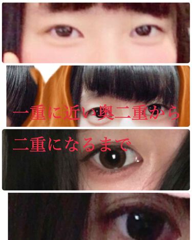 ダブルアイリキッド Abを使った口コミ 今までいろんなことをしても二重になってく By ひまわり 脂性肌 10代後半 Lips