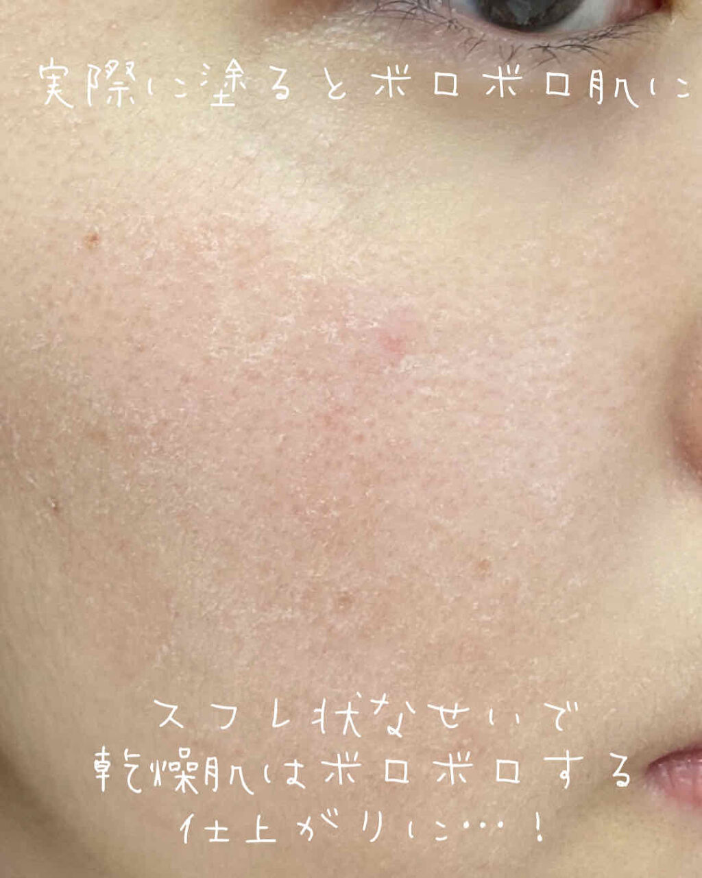 クラブ すっぴんパウダー クラブを使った口コミ 裏技 バレないスクールメイク 今回はクラブ By Mina フォロバ100 敏感肌 代前半 Lips