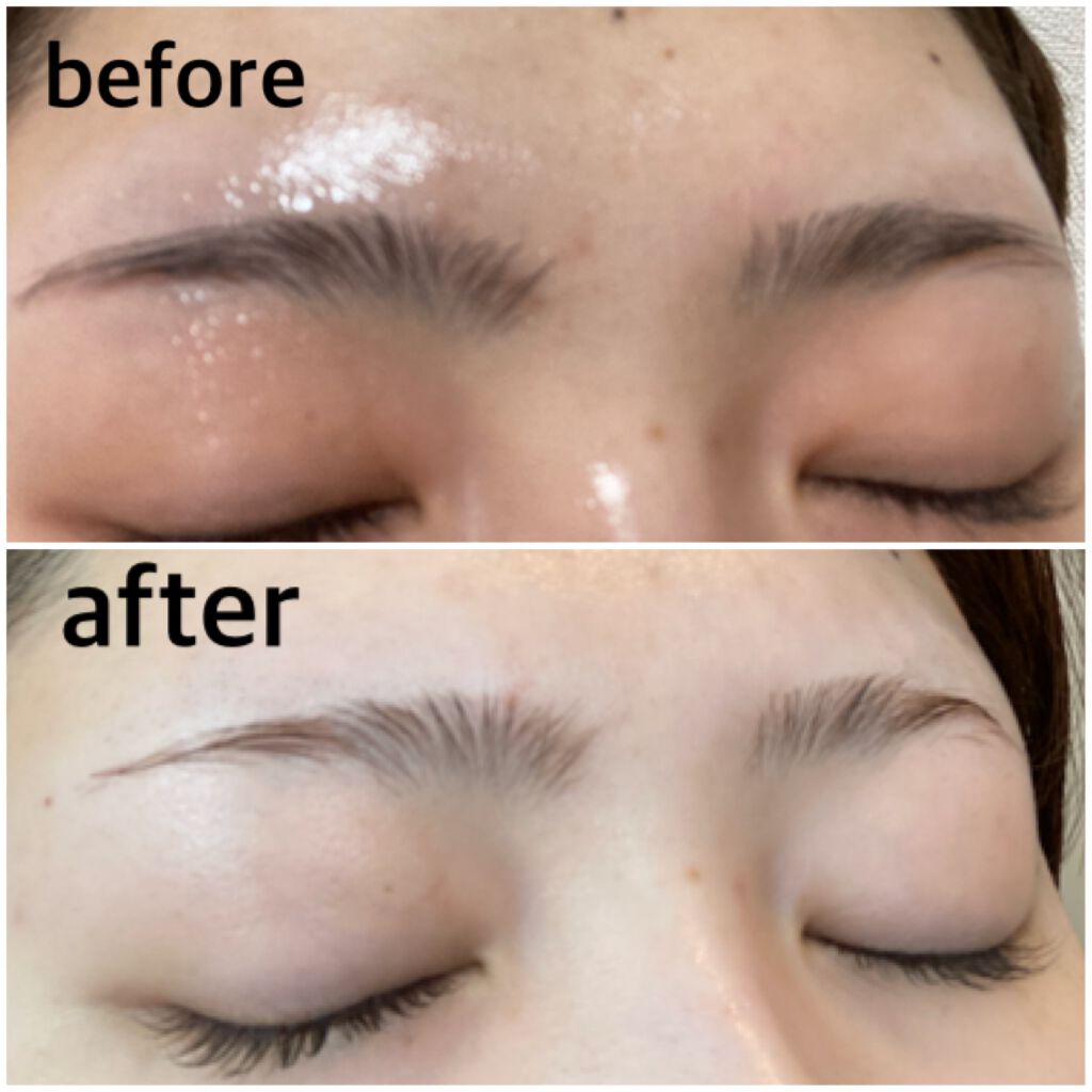 脱色クリームスピーディー エピラットを使った口コミ 眉毛脱色のやり方をご紹介 画像で詳しく By Hamu 敏感肌 代前半 Lips