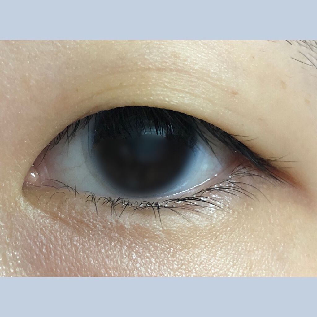 アイトーク アイトークの口コミ 助けてください これって瞼が伸びている状態 By こはく 混合肌 10代後半 Lips