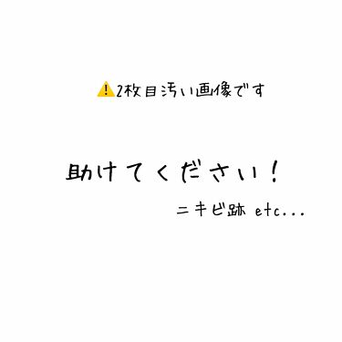 極潤 ヒアルロン液 ライトタイプ 肌ラボを使った口コミ 2枚目汚い画像です 注意です はじめま By 黒田 乾燥肌 10代後半 Lips