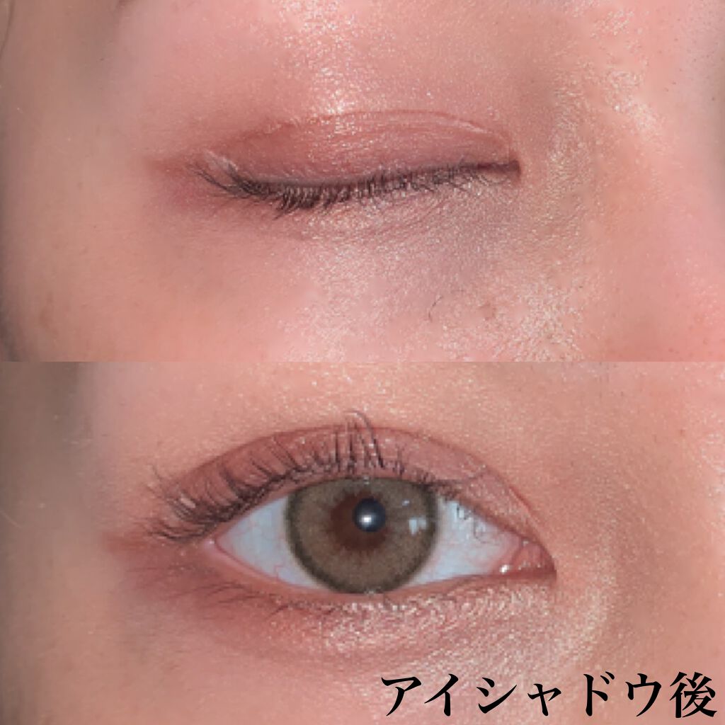 リキッドフィルム 2 ラクオリの口コミ アイプチ必須のみなさんに見てほしい ラクオ By Mana 乾燥肌 代前半 Lips