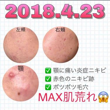 乳液 敏感肌用 高保湿タイプ 無印良品を使った口コミ 皆さまお久しぶりです もう私のことなんてき By H 混合肌 代前半 Lips