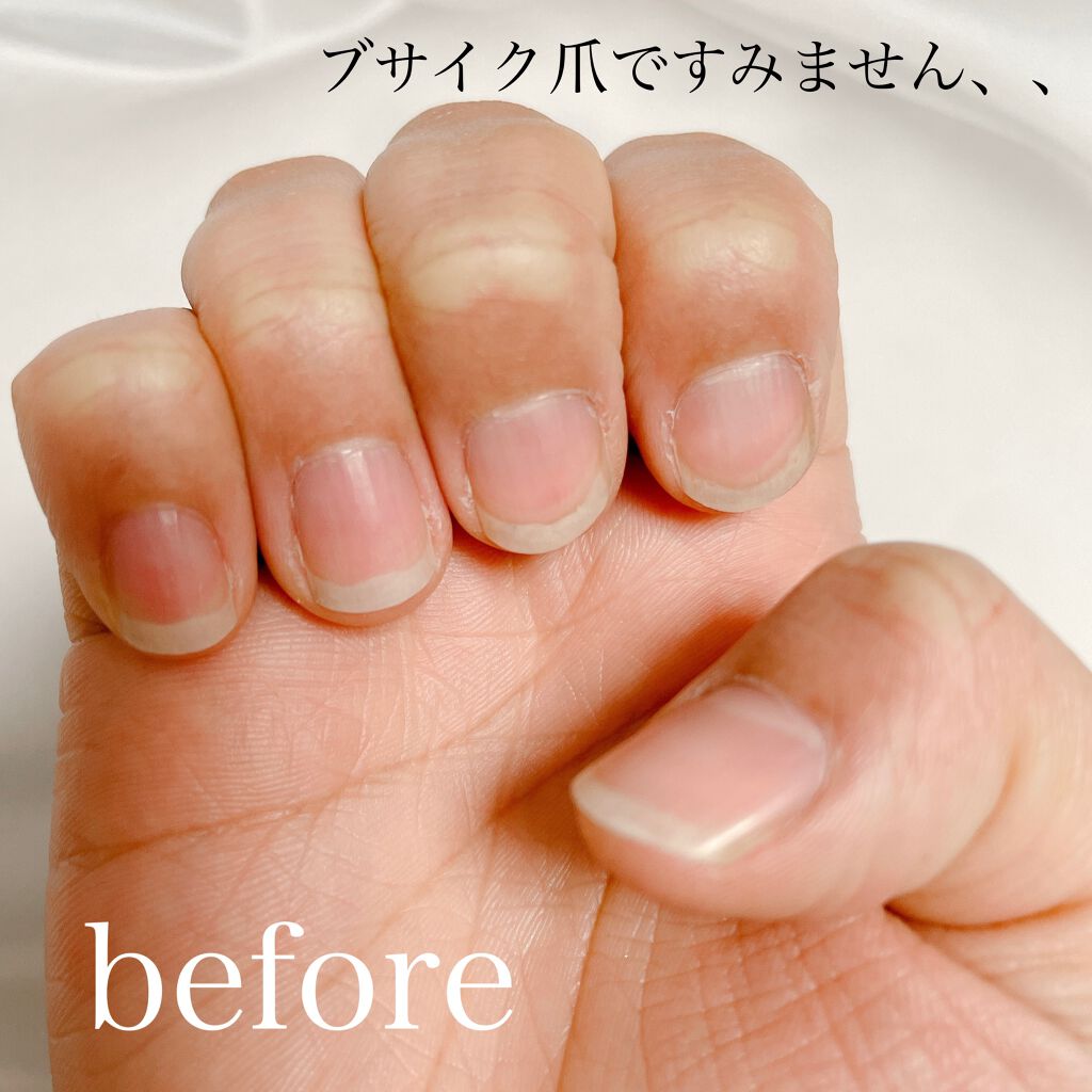 ディーアップファンデーション D Upの口コミ 学校や仕事でネイルできない方必見 すっぴ By Muu フォロバ100 乾燥肌 Lips