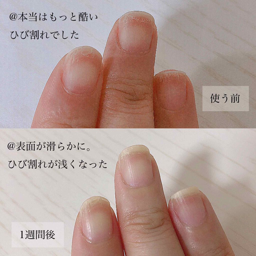 リペクト ネイルセラム D Upの口コミ 𓂃𓈒𓏸お高い 私には笑 ネイルケアの1週間 By もか 混合肌 Lips リペクト ネイルセラム D Upの口コミ 𓂃𓈒𓏸お高い 私には笑 ネイルケアの1週間 By もか 混合肌 Lips