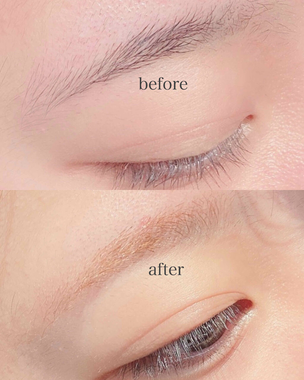 脱色クリームスピーディー エピラットの口コミ せっかくのおうち時間 眉の脱色で垢抜てみま By Ru 脂性肌 10代後半 Lips