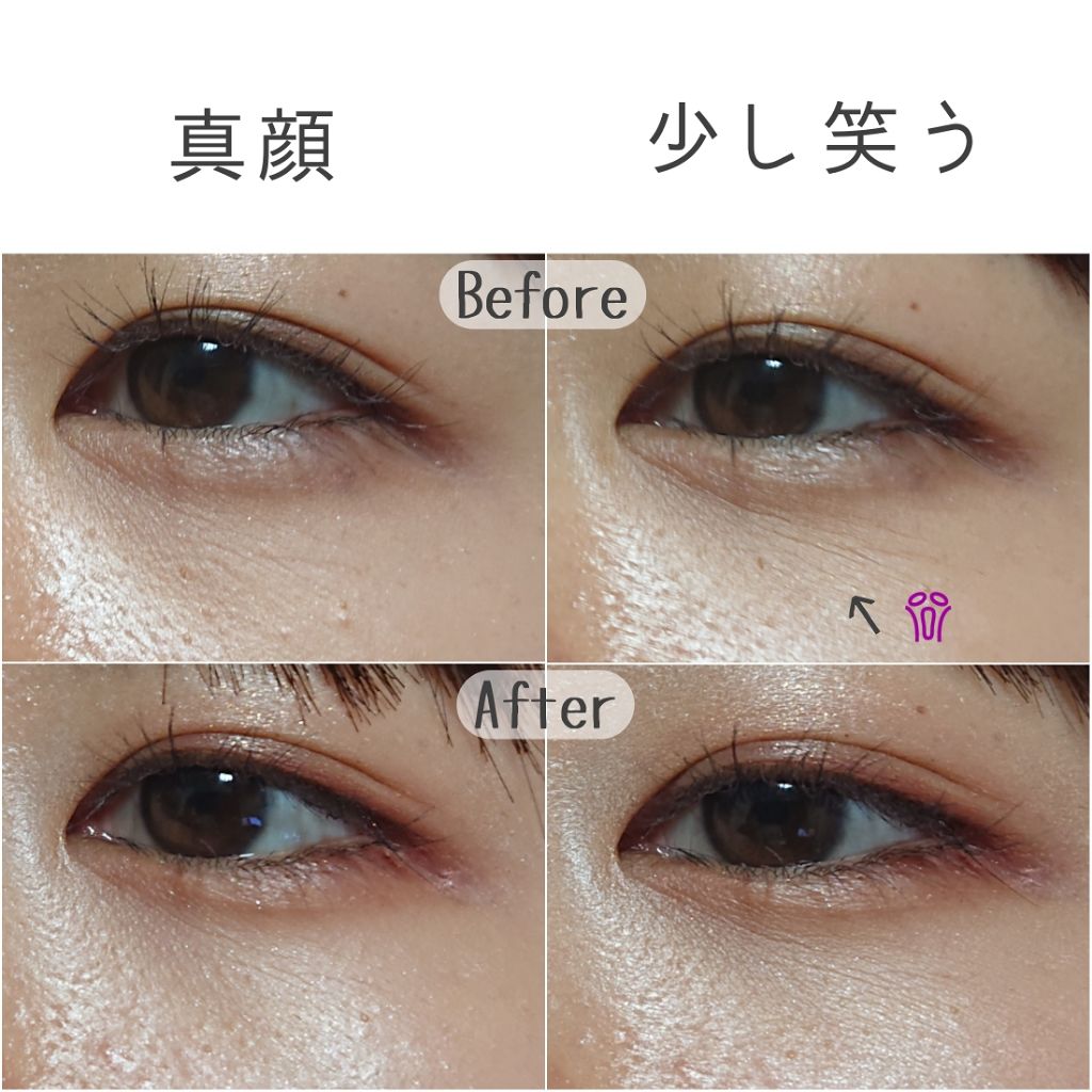 Eyejamのアイケア アイクリームを徹底比較 アイジャムb アイジャムmを比べてみました 気温がだいぶ下がり冬が By もも 代前半 Lips