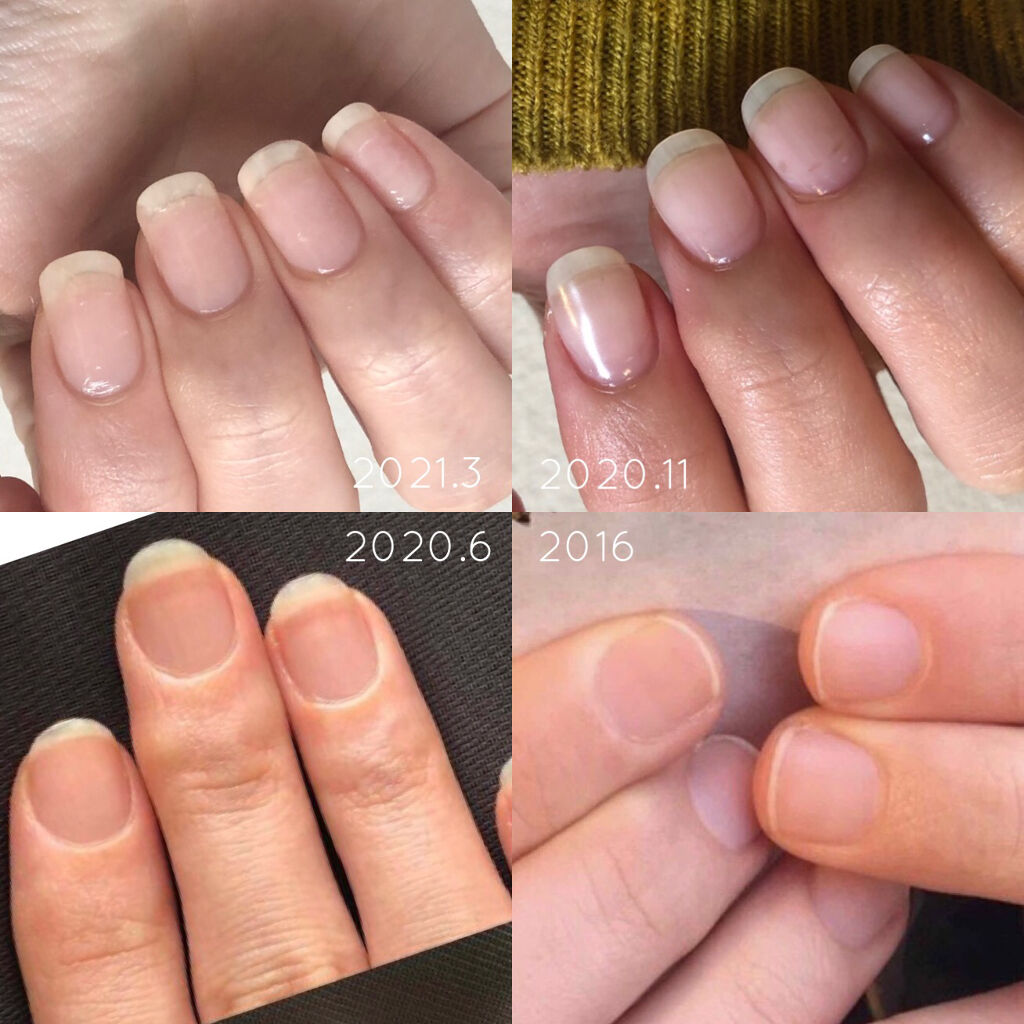 スウィートアーモンドオイル 無印良品の口コミ 育爪経過報告 2月 3月ついにセルフネイ By てらお 敏感肌 代後半 Lips