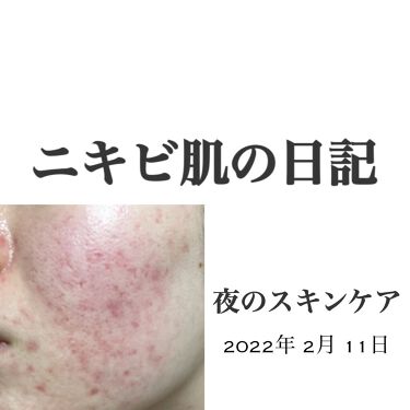 マイルドクレンジング オイル ファンケルを使った口コミ ニキビ肌の日記 今日の夜のスキンケア By ふかさん 脂性肌 代前半 Lips