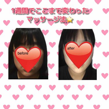 ニベアクリーム ニベアの口コミ こんにちは 今回はマッサージ法を紹介したい By Ririka 乾燥肌 10代後半 Lips