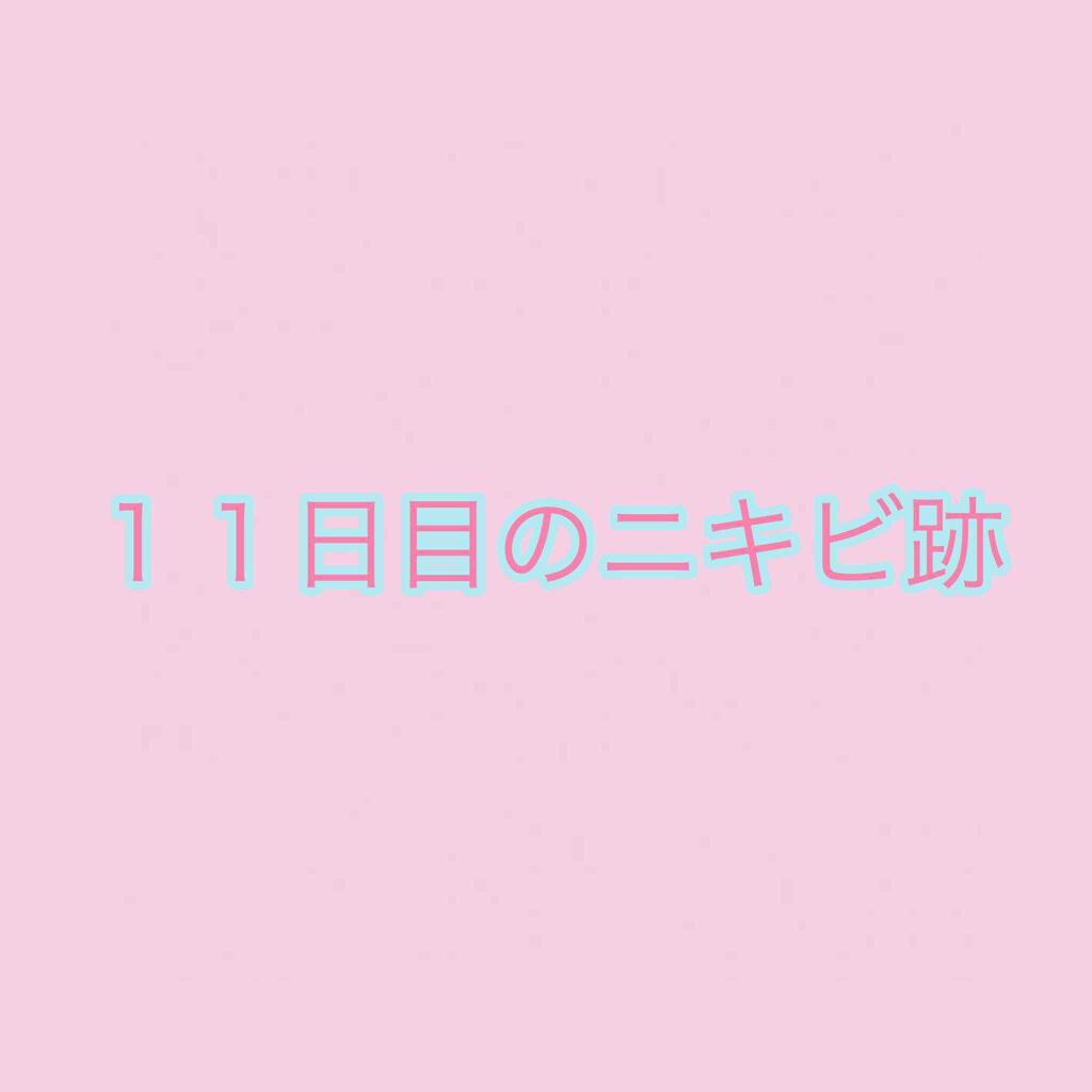 マルチビタミン 栄養機能食品 ビタミンb1 ビタミンc ビタミンe Dhcを使った口コミ いつもこんな汚肌野郎の投稿にいいねをくださ By あさひ 敏感肌 Lips
