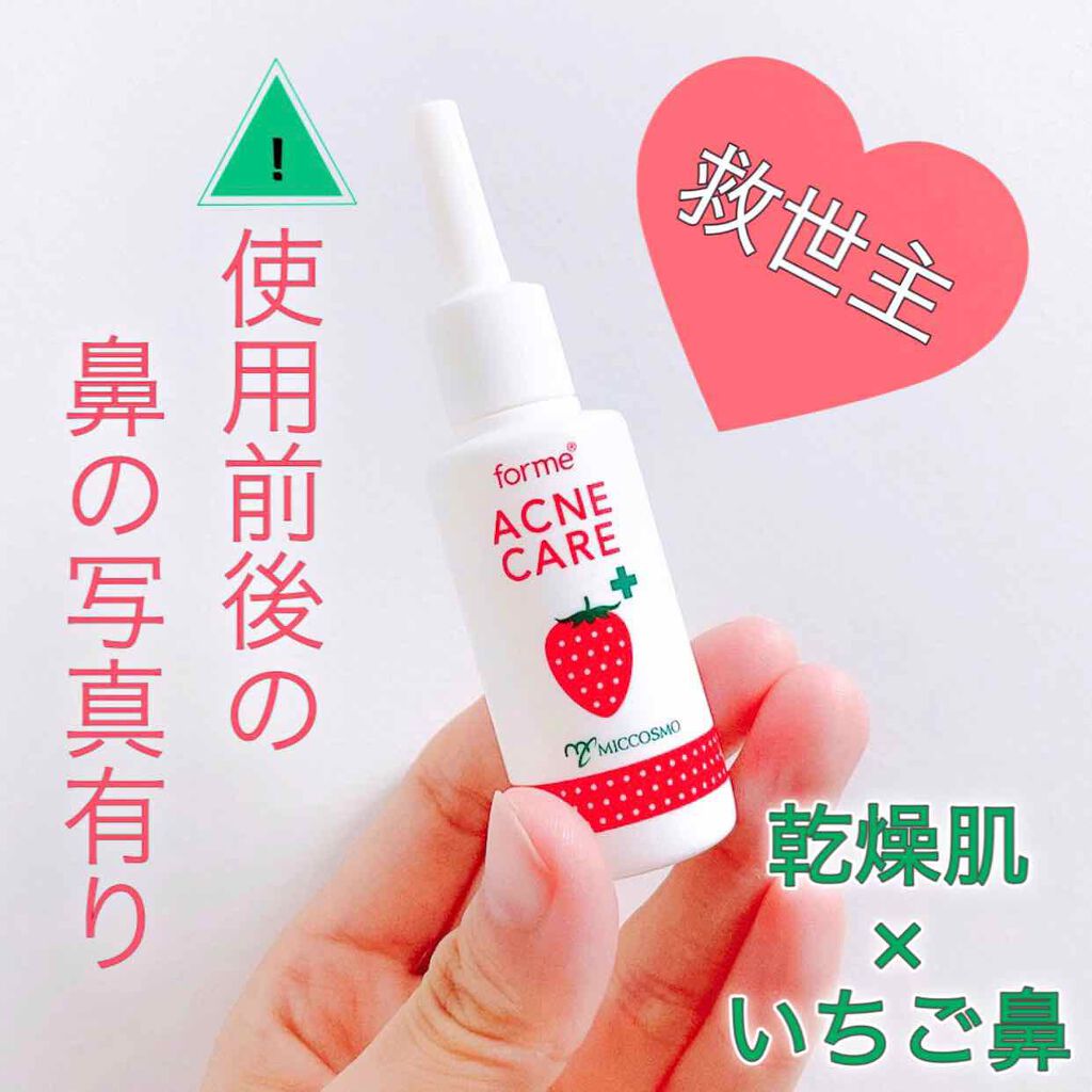 イチゴ鼻薬用はがさないパック フォーミィの使い方を徹底解説 乾燥肌におすすめの洗い流すパック マスク フォーミィ Acne By Kanako Is 乾燥肌 Lips