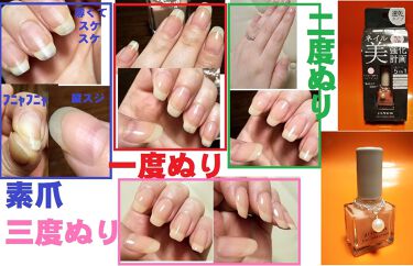 トリートメントネイルハードナー Jilworsの口コミ セブンのネイルファンデより上 こんな By かずおいーめい 普通肌 Lips