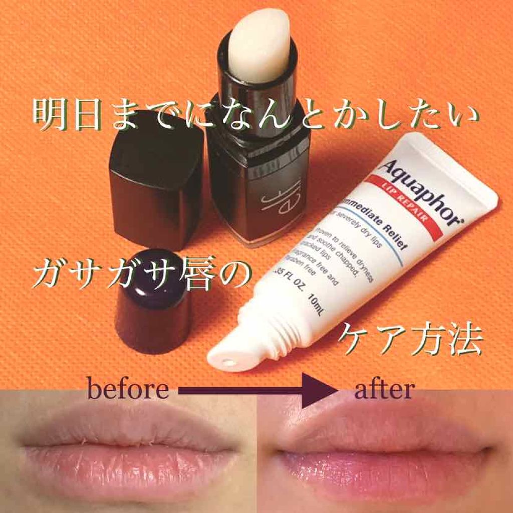 Lip Exfoliator E L Fの口コミ ガサガサゴソゴソな唇をなんとかしたい時に私 By ななみ 混合肌 代後半 Lips