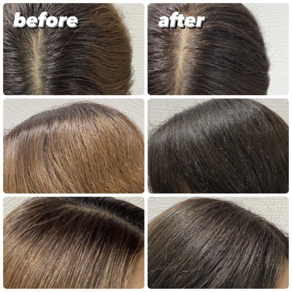 泡カラー 医薬部外品 リーゼの口コミ リーゼ 泡カラーダークショコラ オープン By おこめ フォロバ100 混合肌 代前半 Lips