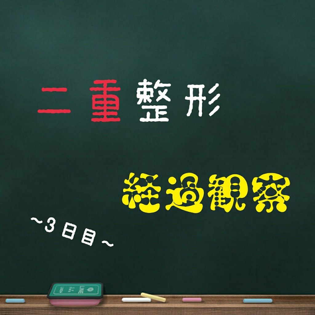 二重整形の画像 動画一覧 17ページ目 Lips