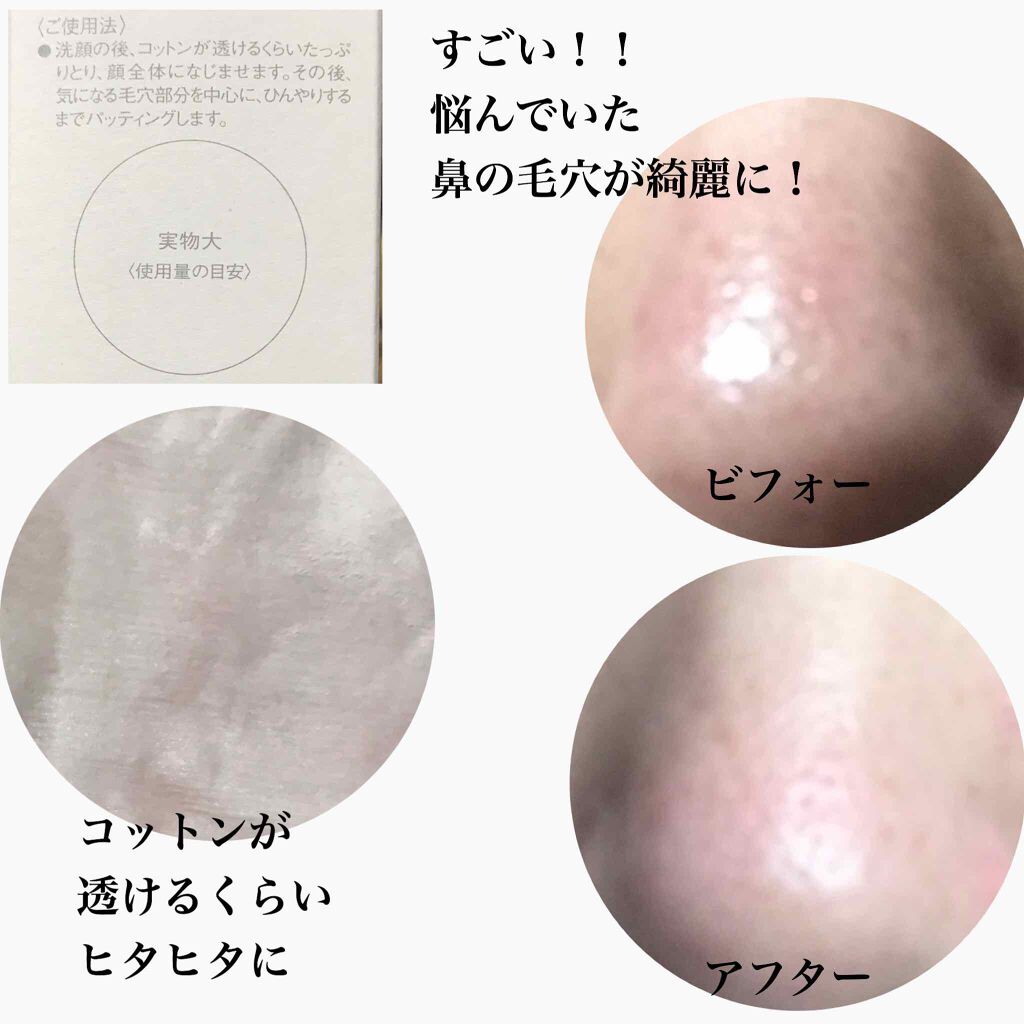 エリクシール ルフレ バランシング ウォーター Ii エリクシールの口コミ エイジングケアにおすすめの化粧水 提供 エリクシール今 By ふくすけ 混合肌 30代前半 Lips