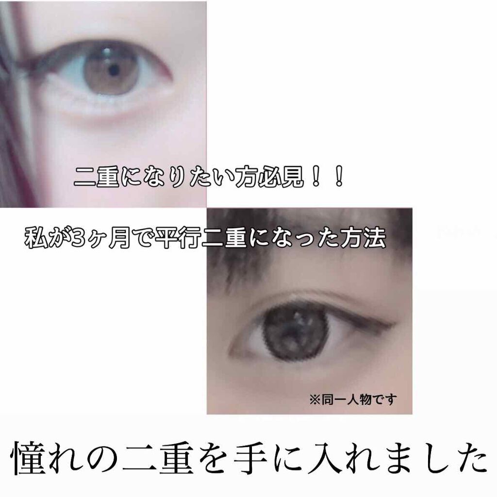 ナイトアイボーテ Streetrendの口コミ 初めまして 凛です 初投稿させていた By 凛 混合肌 10代後半 Lips