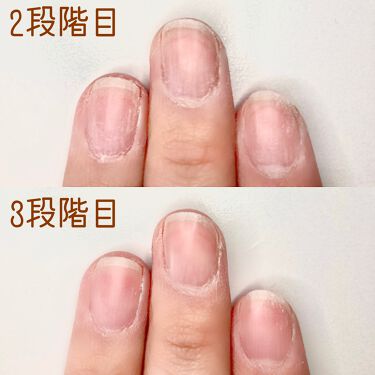 爪磨き 爪ヤスリ Daisoの口コミ 超優秀 100均で買えるおすすめネイル用品 100円で By 𝕂𝔸ℕ𝕆𝕂𝕆 Lips