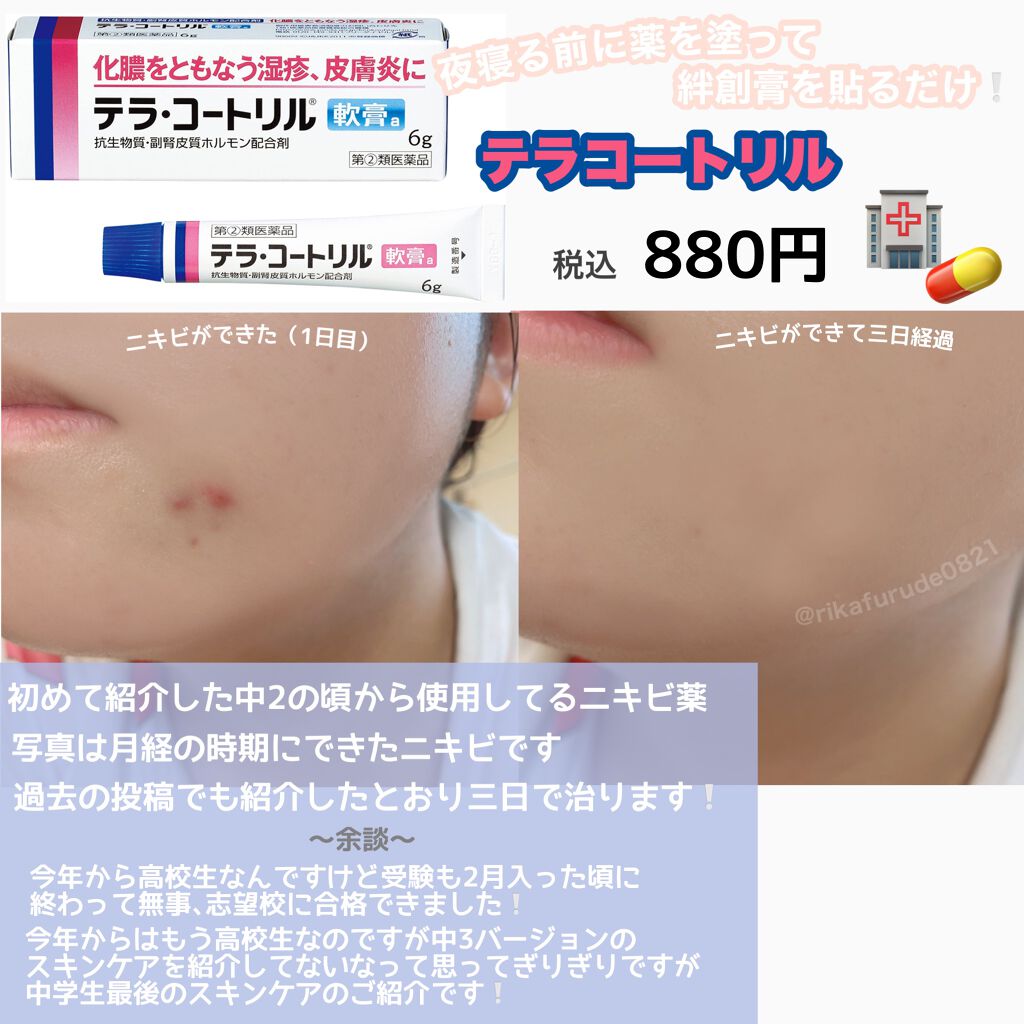 化粧水 敏感肌用 しっとりタイプ 無印良品を使った口コミ こんにちはcoaです 今回はもう 高校生に By Coa 10代後半 Lips