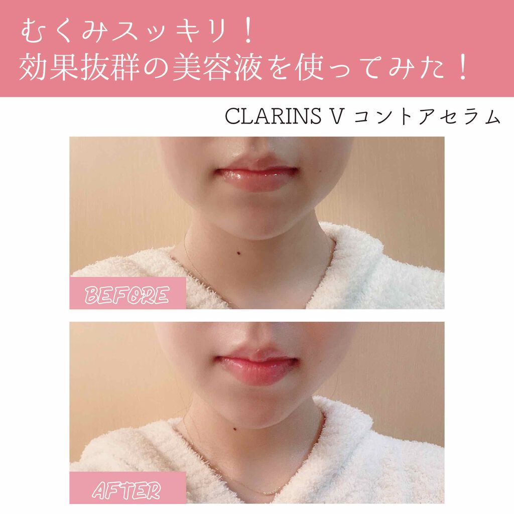 年春新作美容液 Vコントアセラム Clarinsの使い方を徹底解説 むくみスッキリ 効果抜群でリピ買い間違 By Maho 乾燥肌 代後半 Lips