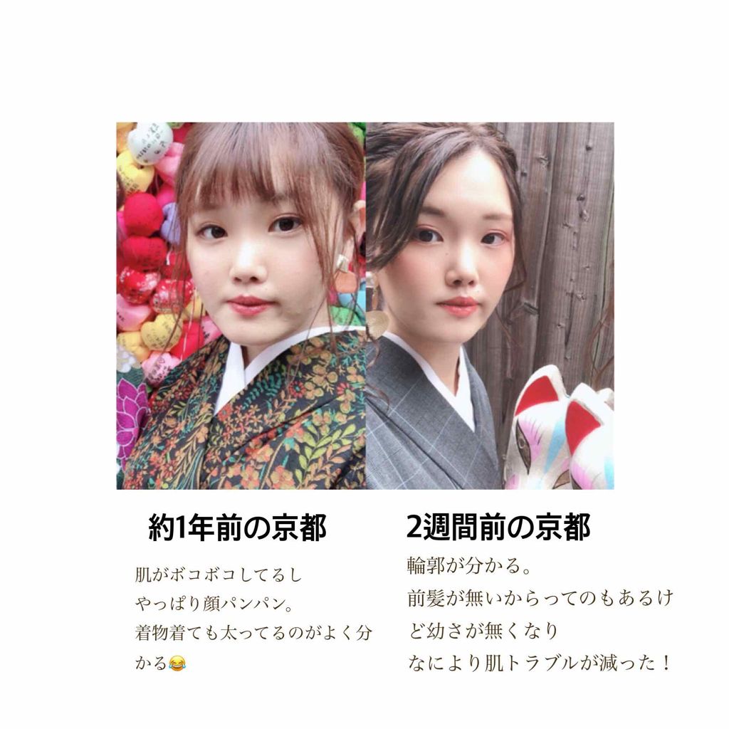 食べてもdiet 井藤漢方製薬の口コミ いつも3日坊主の私が1年で 10kg以上の By Nanako 敏感肌 代前半 Lips 食べてもdiet 井藤漢方製薬の口コミ いつも3日坊主の私が1年で 10kg以上の By Nanako 敏感肌 代前半 Lips