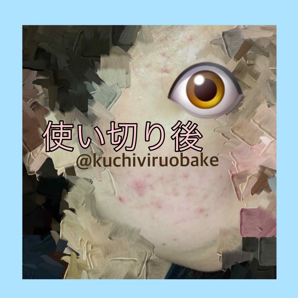 薬用プレミアムアクネケアローション Emione エミオネ の口コミ ニキビケアにおすすめの化粧水 写真はノーファンデ By 藻 乾燥肌 代前半 Lips