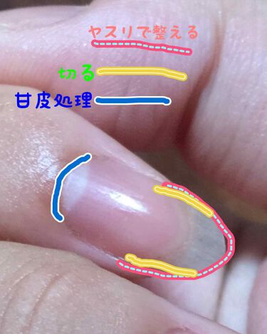 ネイルホリック キューティクルオイル ネイルホリックの口コミ 甘皮処理のポイント 明らかに甘皮とわかる部 By Rim 敏感肌 Lips