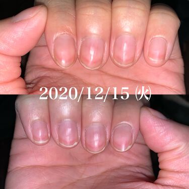 オイルインキューティクルプッシャーペン ビューティーワールドを使った口コミ 爪床伸ばしてみた 最後まで見てくれ By 𝑀𝐸𝑅𝑅𝑌 Lips