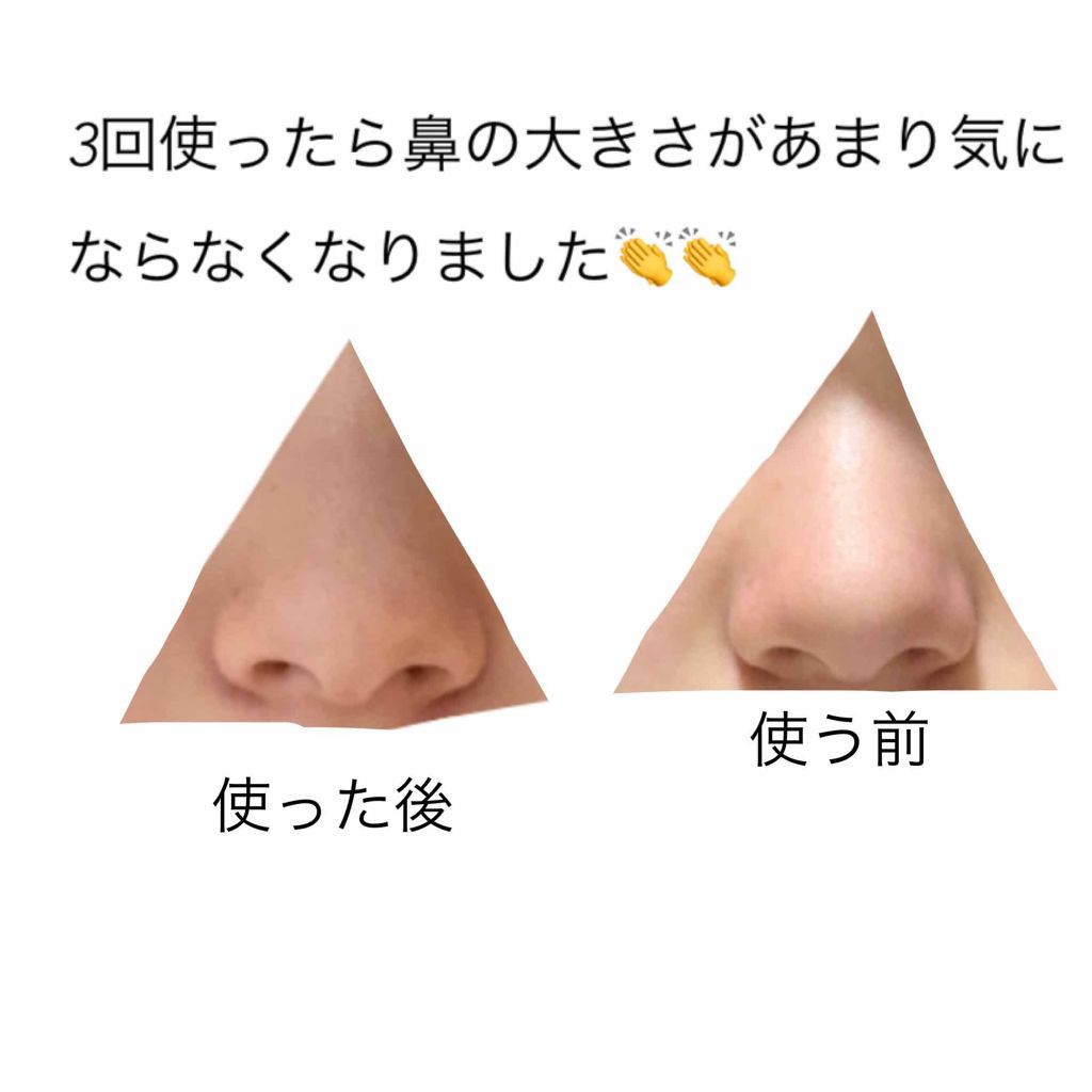 ノーズトレーナー Daisoの使い方を徹底解説 超優秀 100均で買えるおすすめスキンケアグッズ Daisoのノーズ By すずか 普通肌 10代後半 Lips