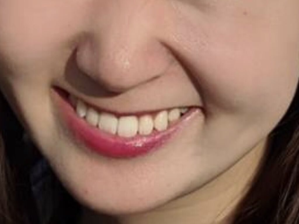 Marvis Marvisを使った口コミ 私の ホワイトニング 術 マービス M By ちゅろす 普通肌 代後半 Lips