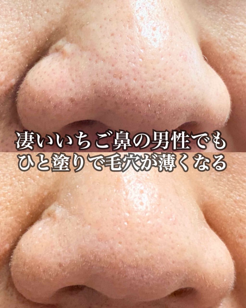 Skin Smoothing Glowrizer Espoirの口コミ 気になってたこのつぶつぶ下地 今日はそん By みたらし ゚ 脂性肌 代後半 Lips