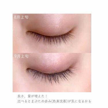 Emaked エマーキット 水橋保寿堂製薬の効果に関する口コミ 𓊆 Emaked𓊇アイリスト時代にこれを By みんく 乾燥肌 Lips