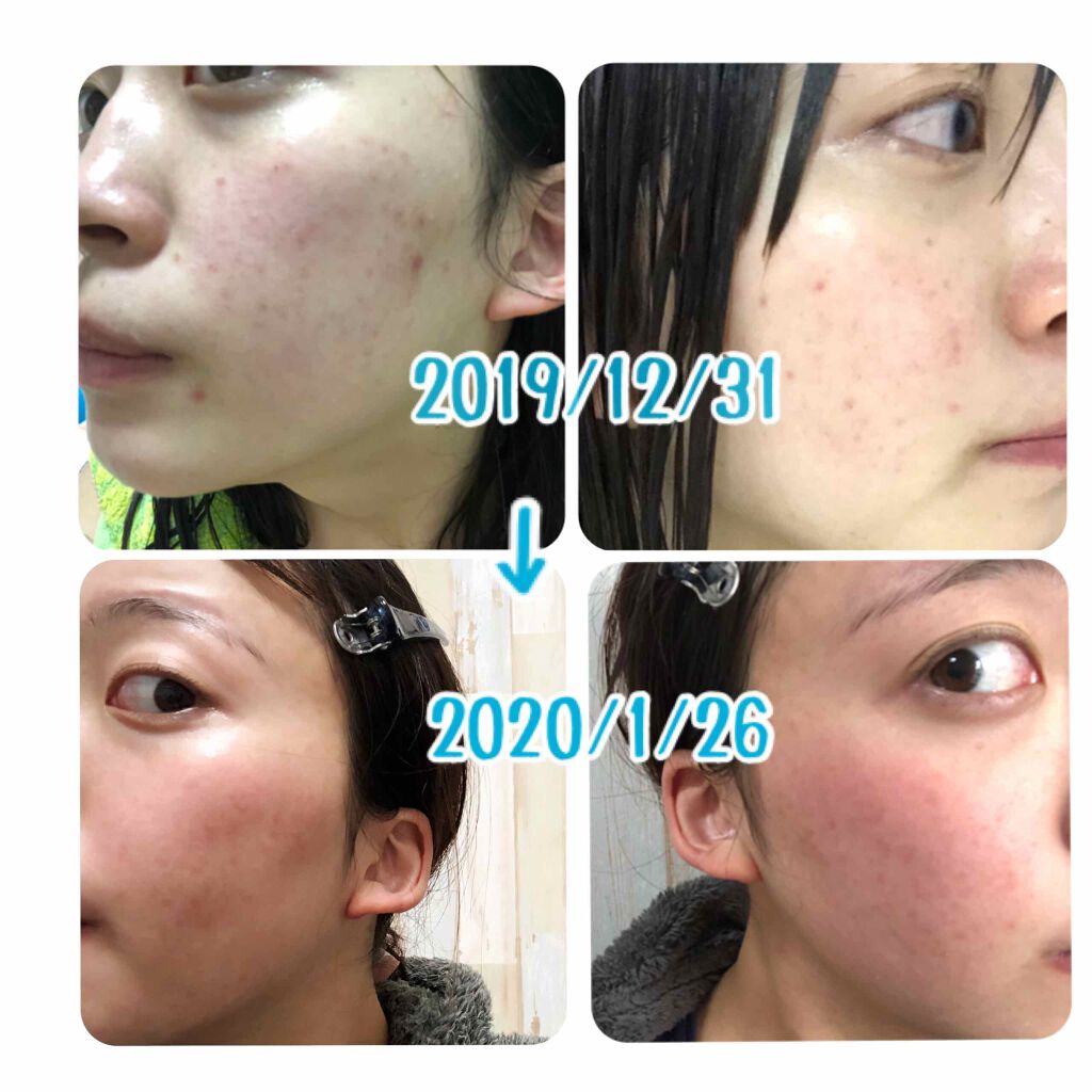 白陶泥洗顔石鹸 ペリカン石鹸の口コミ 乾燥肌におすすめの洗顔石鹸 モコモコ泡洗顔 By まるちゃそ 敏感肌 代前半 Lips