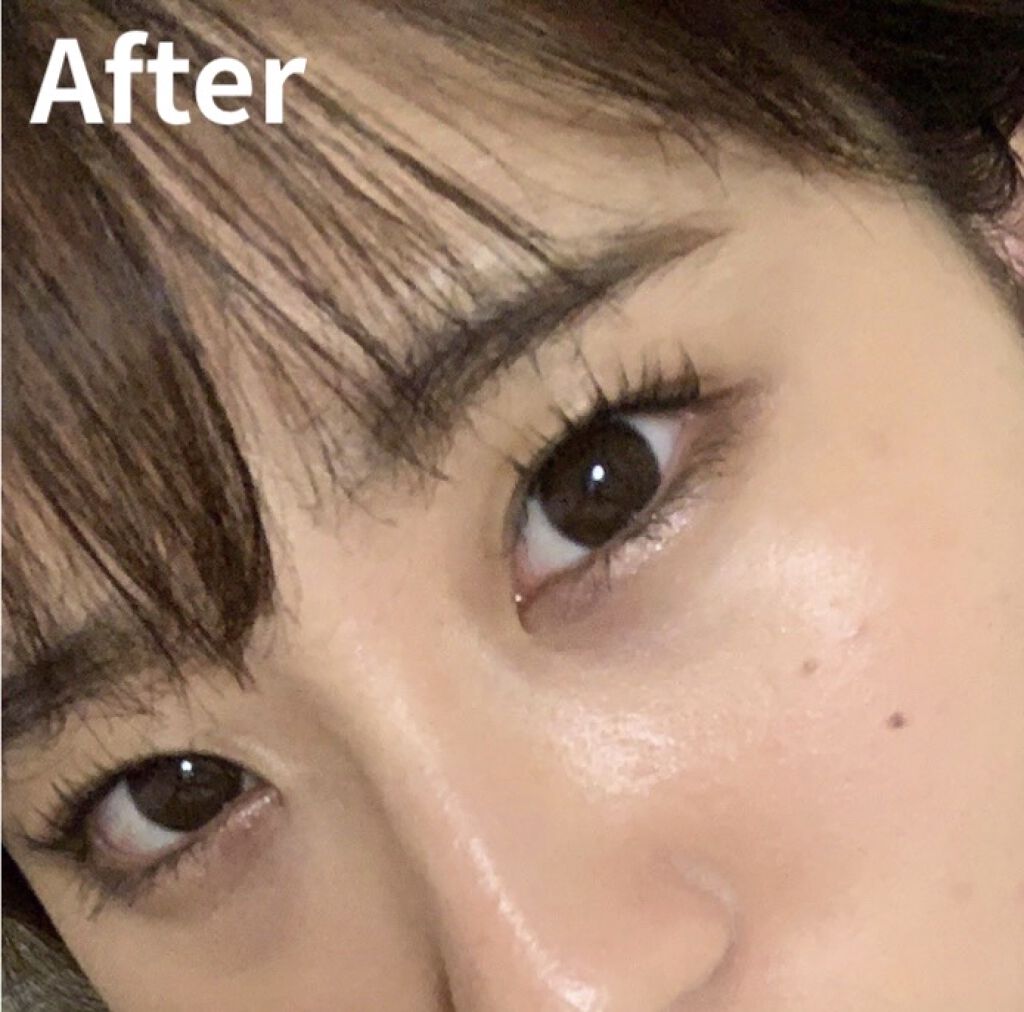 コラーゲンピーリングジェル 旅美人を使った口コミ ズボラ女子でも水光肌になりたくて 初投 By 暖花danka 混合肌 代前半 Lips