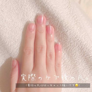 つめやすり Daisoを使った口コミ こんにちは 初めての投稿となりますぶたきむ By ぶたきむち 乾燥肌 10代後半 Lips